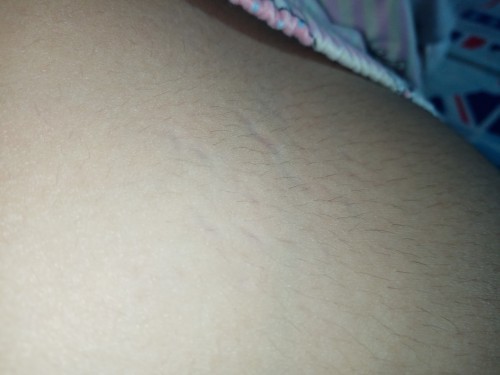 อันนี้ใช่รอยแตกรึป่าวคะ?