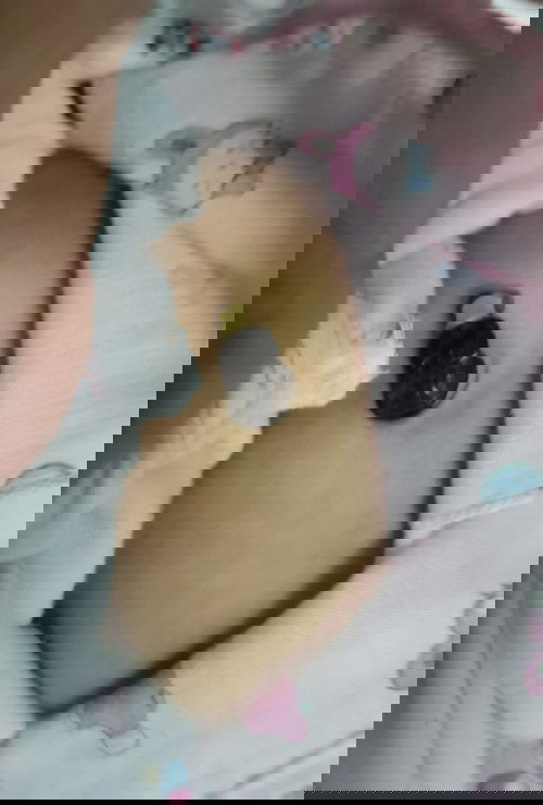 สะดือไม่หลุด