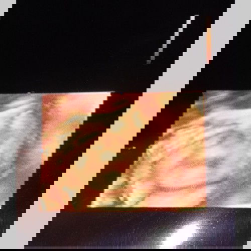 ภาพอัลตร้าซาวด์  จมูกน้องทำไมเป็นเเบบนี้ค่ะ