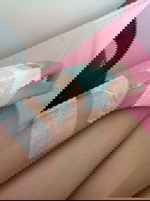 โดนเร่งคลอดแล้วจ้าา