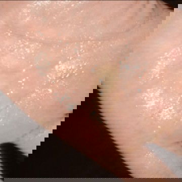 มีมูกเเบบนี้หลุดออกมาค่ะ ปกติรึป่าวคะควรไปหาไหมคะ มีปวดท้องร่วมด้วย ท้องเเข็งไม่ถี่ค่ะ มีใครเป็นบ้าง