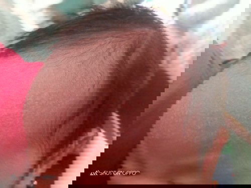 Tanya dong biang keringat di jidat pake apa y