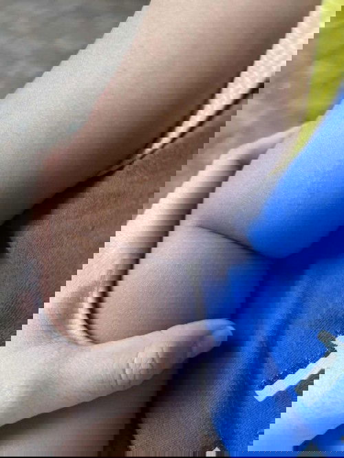 ใครเคยเป็นบ้างคะ