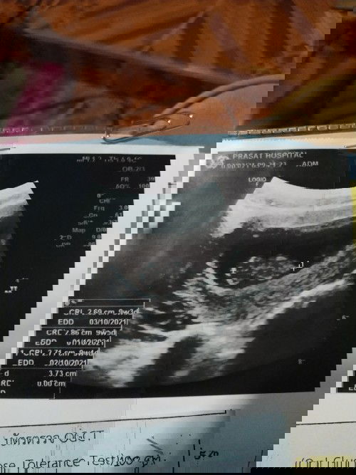 แม่ๆท่านไหนดูออกบ้างค่ะว่าชายหรือหญิง