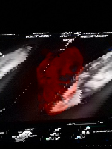 น้องยังไม่กลับหัว