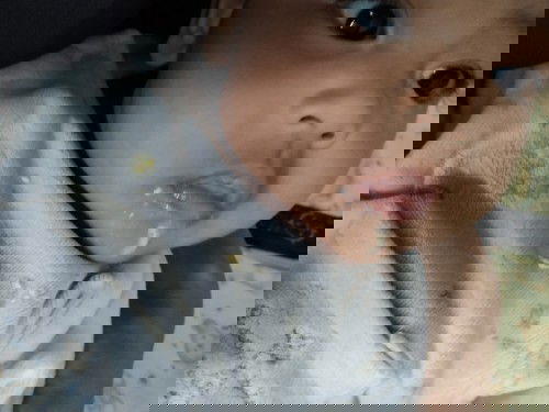 น้องมีอาการหายใจครือคราดแล้วมีอาการไอเล็กน้อย เมื่อเช้าน้องแหวะนมออกมามีหลิ่มๆสีเหลืองแบบในภาพ🥺