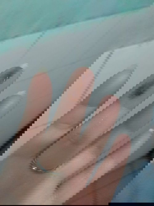 เลือดออกแบบนี้อันตรายไหม