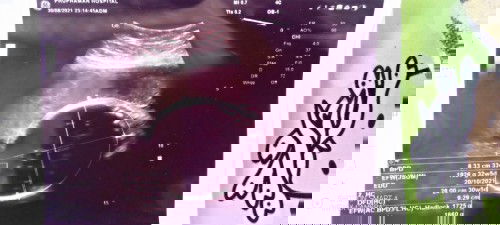 ใช่น้องมั้ยคะน้องตัวเล็กไปหรือเปล่า