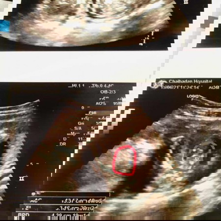 แม่ๆช่วยดูหน่อยค่ะ