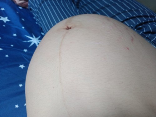 37w4วัน ท้องใหญ่แต่น้ำหนักน้องน้อยมากเลยค่ะ 2,181g กินนมวันละ2-3กล่อง บำรุงทุกอย่าง