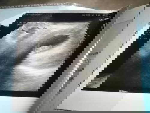 ขออนุญาต​สอบถามแม่ๆนะคะ