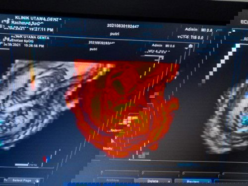 Perhitungan usia kandungan