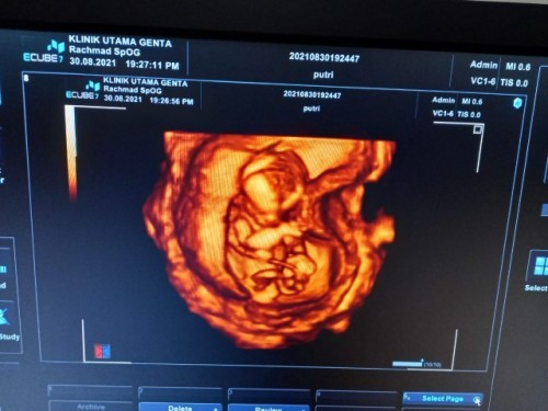 Perhitungan usia kandungan