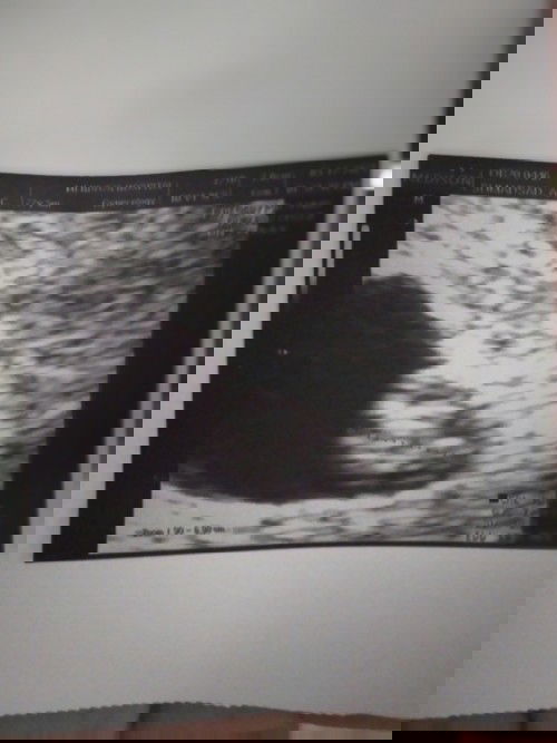 Hello po mga mommies any idea po  hm po bag nng dugo type 0+ hinihingan po kse ako bago manganak .