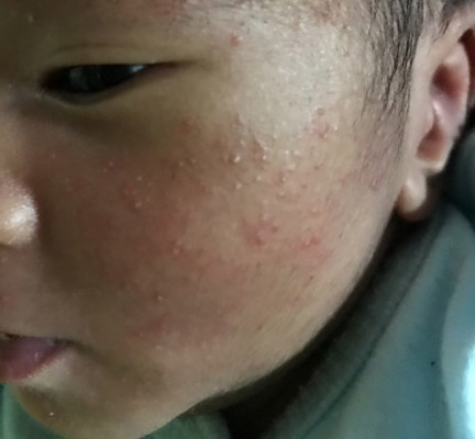 เเม่ๆคะขอถามหน่อยค่ะ