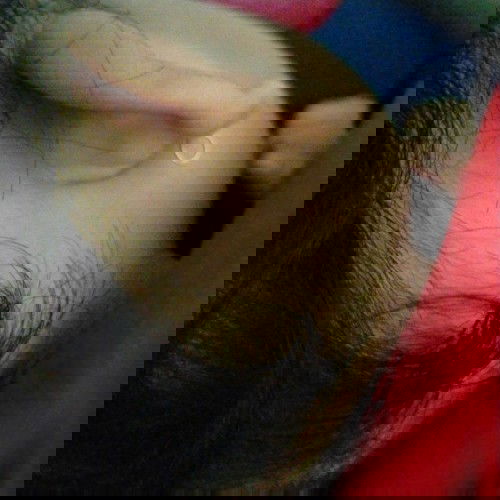 Benjolan di belakang telinga bayi 10bln