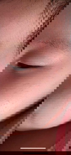 Mấy m cho e hỏi mặt con e bị nổi những mụn li ti như v là bị gì v ạ? Bé nhà e đc gần 2 tháng rồi