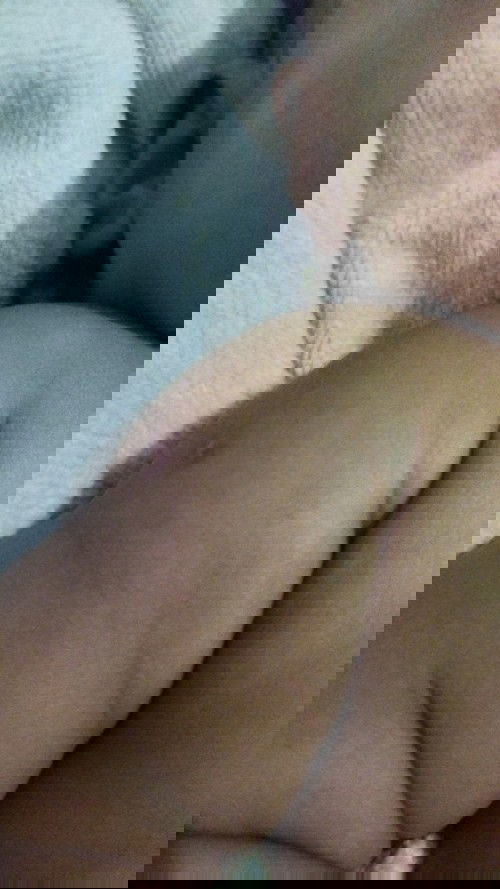 Bekas suntik imunisasi bulan pertama