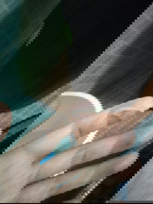 แม่ๆค่ะท้องได้38+3ค่ะมีแบบนี้ออกมาทางช่องคลอดค่ะอยากถามแม่ๆว่ามันคืออ่ะไรอันตรายไหมออกมาสองรอบแล้วค่