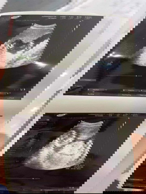 สอบถามแม่หน่อยคะ