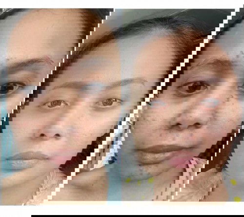 DAKI BANYAK BETUL SAMPAI HITAM KETIAK LUTUT SIKU