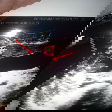 Wrong gender🤦🤰