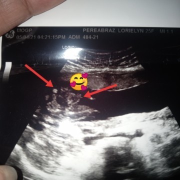 Wrong gender🤦🤰