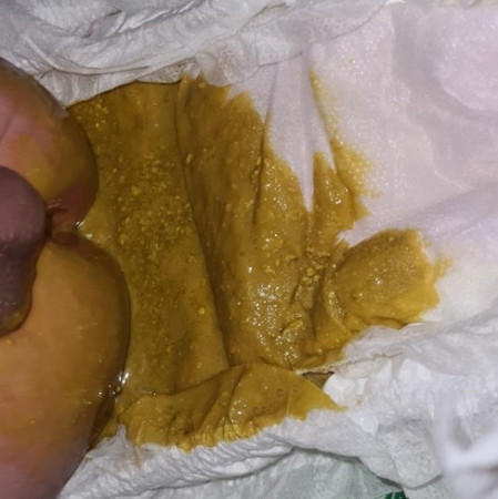 Is this diarrhoea?