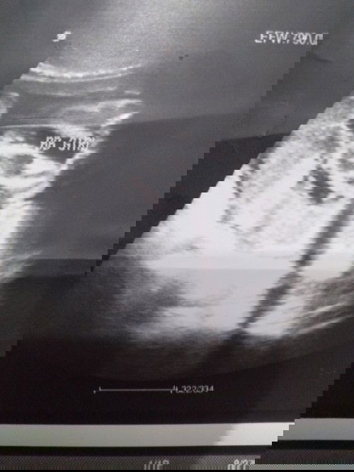 Baby girl ♀️🎉