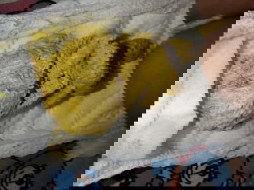 Masalah pada pup bayi