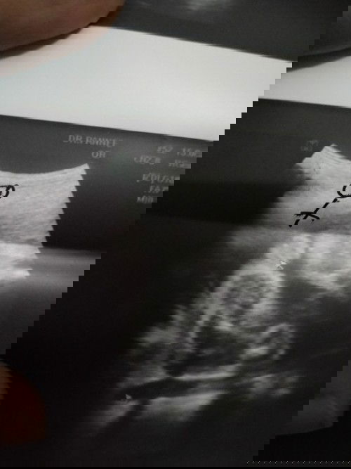 หญิงใช่ไหมค่ะ