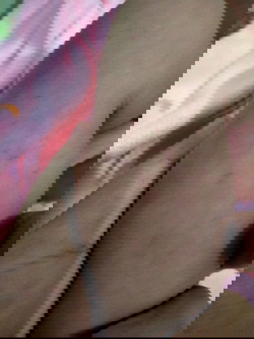 Timbul bintik hitam kemerahan di kaki baby