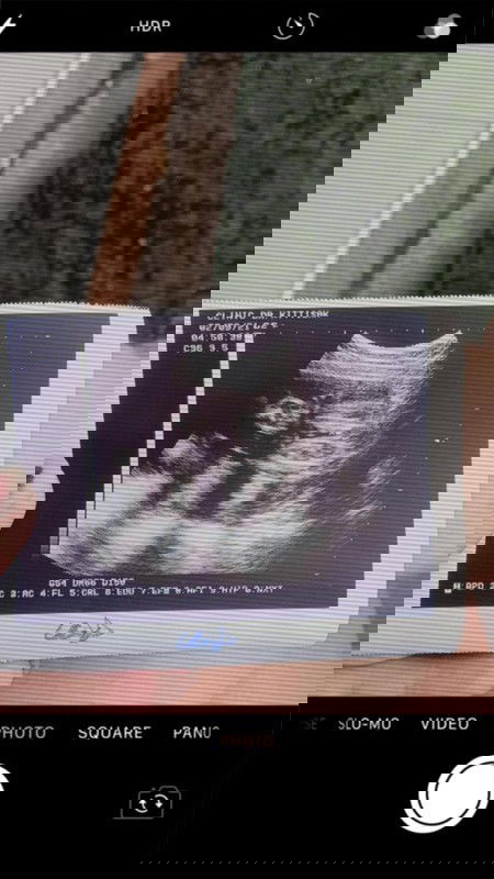 เพศลูก👶🏻👶🏻👶🏻👶🏻