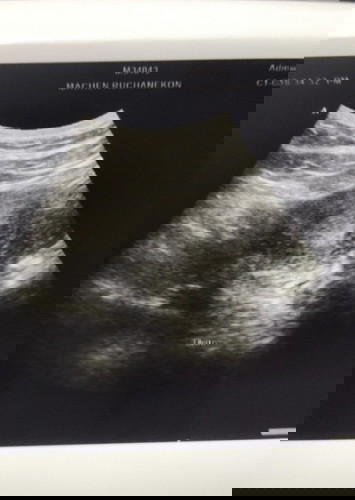 ขอสอบถามผู้รู้ค่ะ