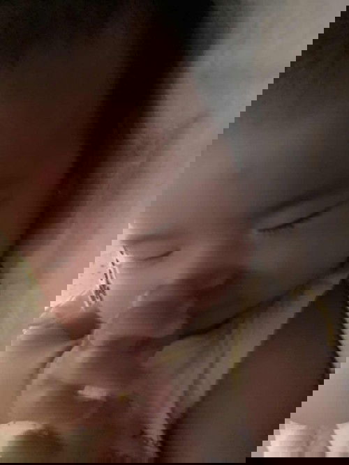 Bentol di gigit nyamuk