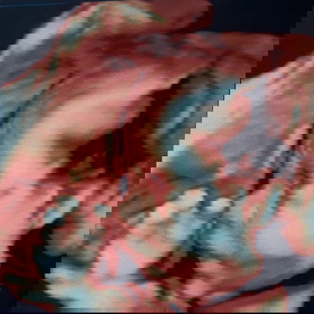 น้ำคล่ำเยอะ