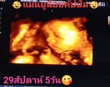 ทีม พ.ย.จ้า💖