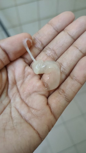 Keluar lendir hari ke 16
