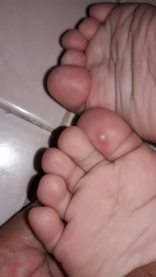 masalah kulit