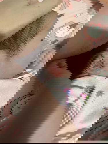 ลูกอายุ 11 วัน มีอาการบวมที่ใบหู