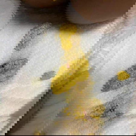 ตอนนี้ลูกอายุ4เดือนกว่าถ่ายมีมูกเลือด