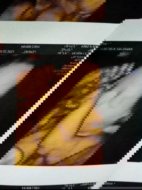 แม่ๆๆคะขอสอบถามหน่อยจ้า