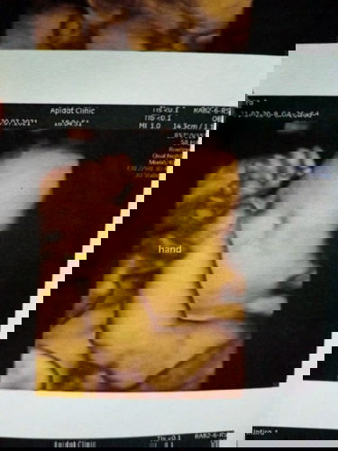 แม่ๆๆคะขอสอบถามหน่อยจ้า