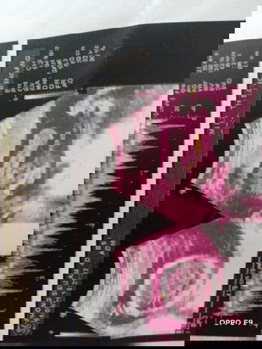 Lần đầu làm mẹ ..20122