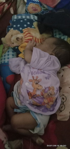 Ada yg sama ngak disini anak baru mau usia satu bulan tidur udh miring