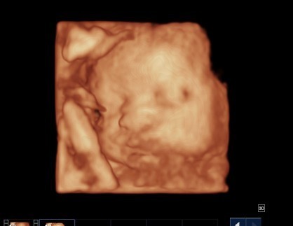 ซาวน์ 4 มิติ