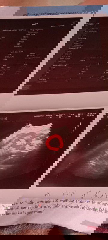 ผู้หญิงหรือผู้ชาย