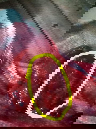 Nakunan, at Hindi buntis