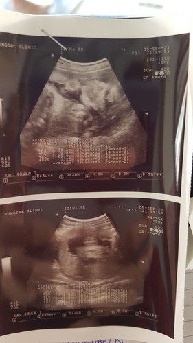 ทีมพฤศจิกายน 29w+5d👶