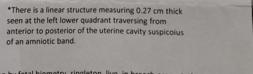 May same case po ba dito sa akin sa CSA may suspicious amniotic band?